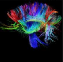 rainbow colored brain image