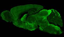 Cortical GABAergic interneurons in mouse brain glowing green.