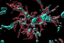 Microglia (red) secrete protein to induce neurodegeneration in mice. Image by Kei Hashimoto/UCSF