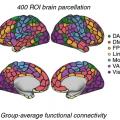   Divided Brain. Researchers defined 400 brain regions. For each one, they measured its tau accumulation and functional connectivity to every other region. Regions that form part of larger networks are color coded. [Courtesy of Franzmeier et al., Nature Communications, 2020.]