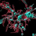 Microglia (red) secrete protein to induce neurodegeneration in mice. Image by Kei Hashimoto/UCSF